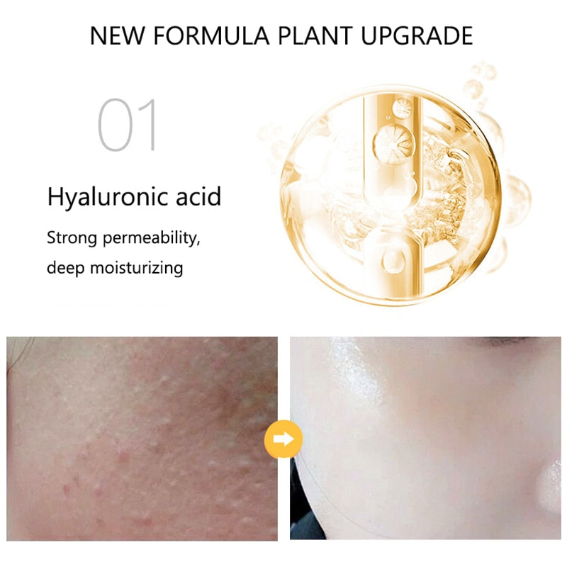 Essence de Niacinamide d'Or 24K, Liquide Nourrit en Profondeur, Anti-déformant, Anti-âge, Acide Hyaluronique, Hydratant pour la Peau du Visage